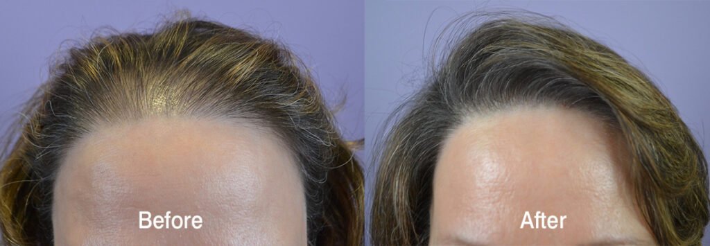 The Hair Mission Clinic