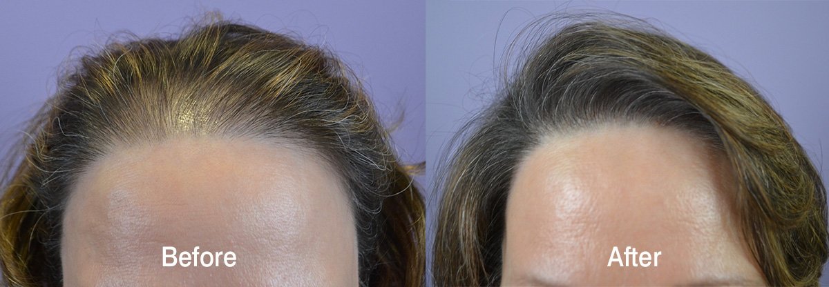 The Hair Mission Clinic