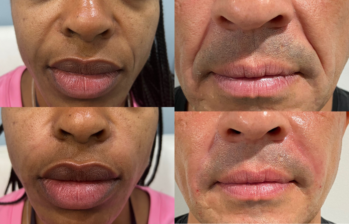 The Hair Mission Clinic