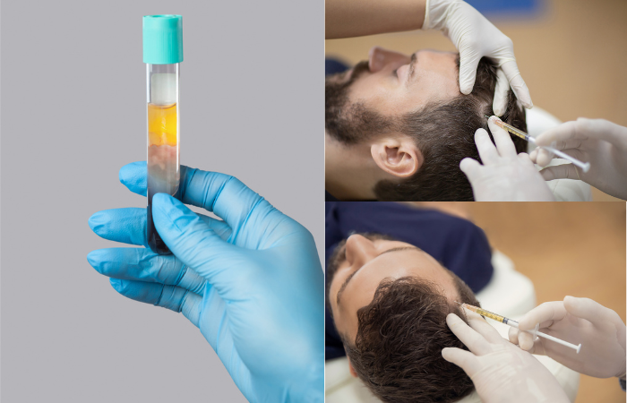 The Hair Mission Clinic