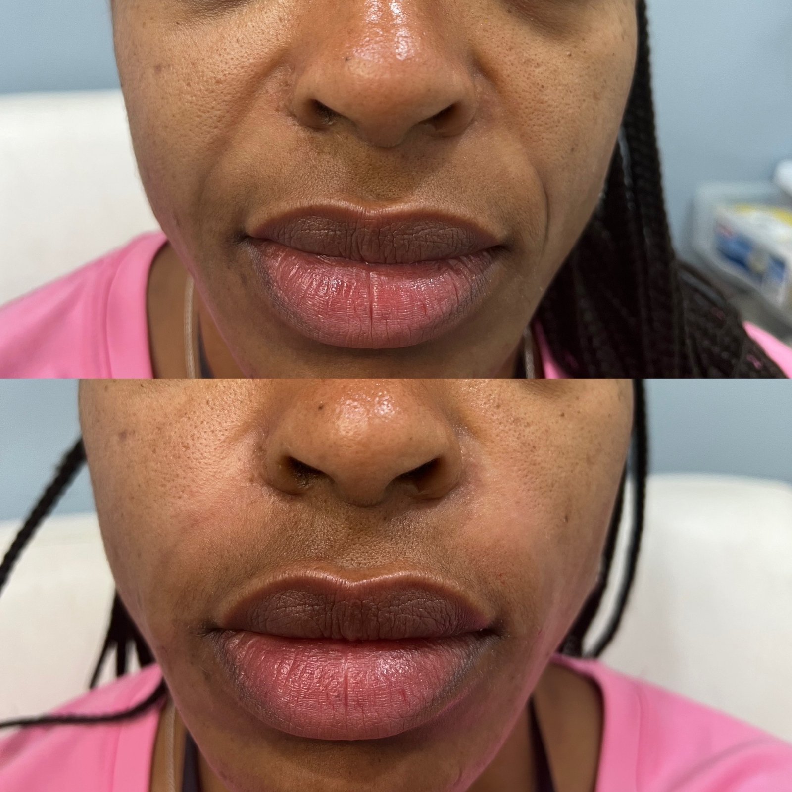 The Hair Mission Clinic