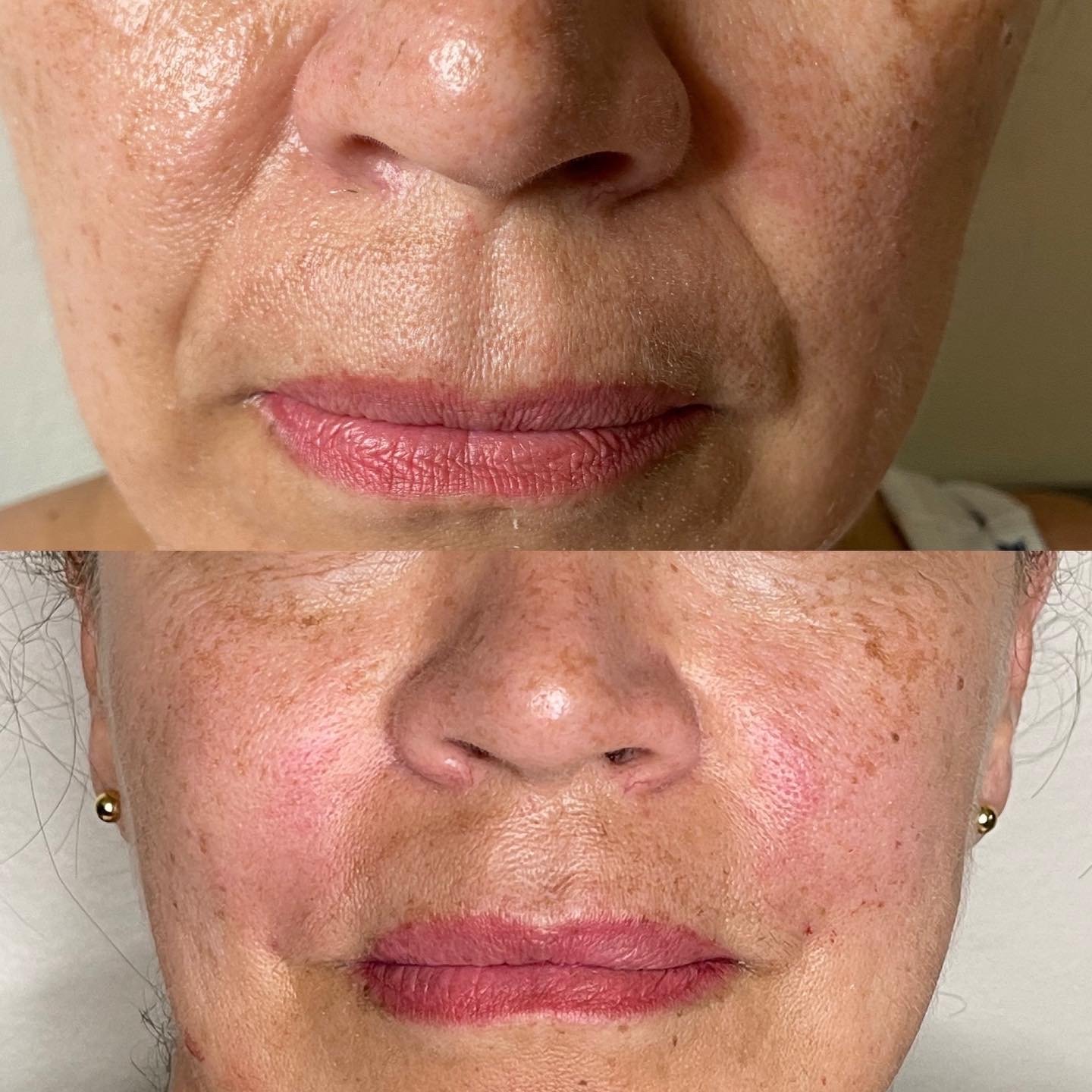 The Hair Mission Clinic