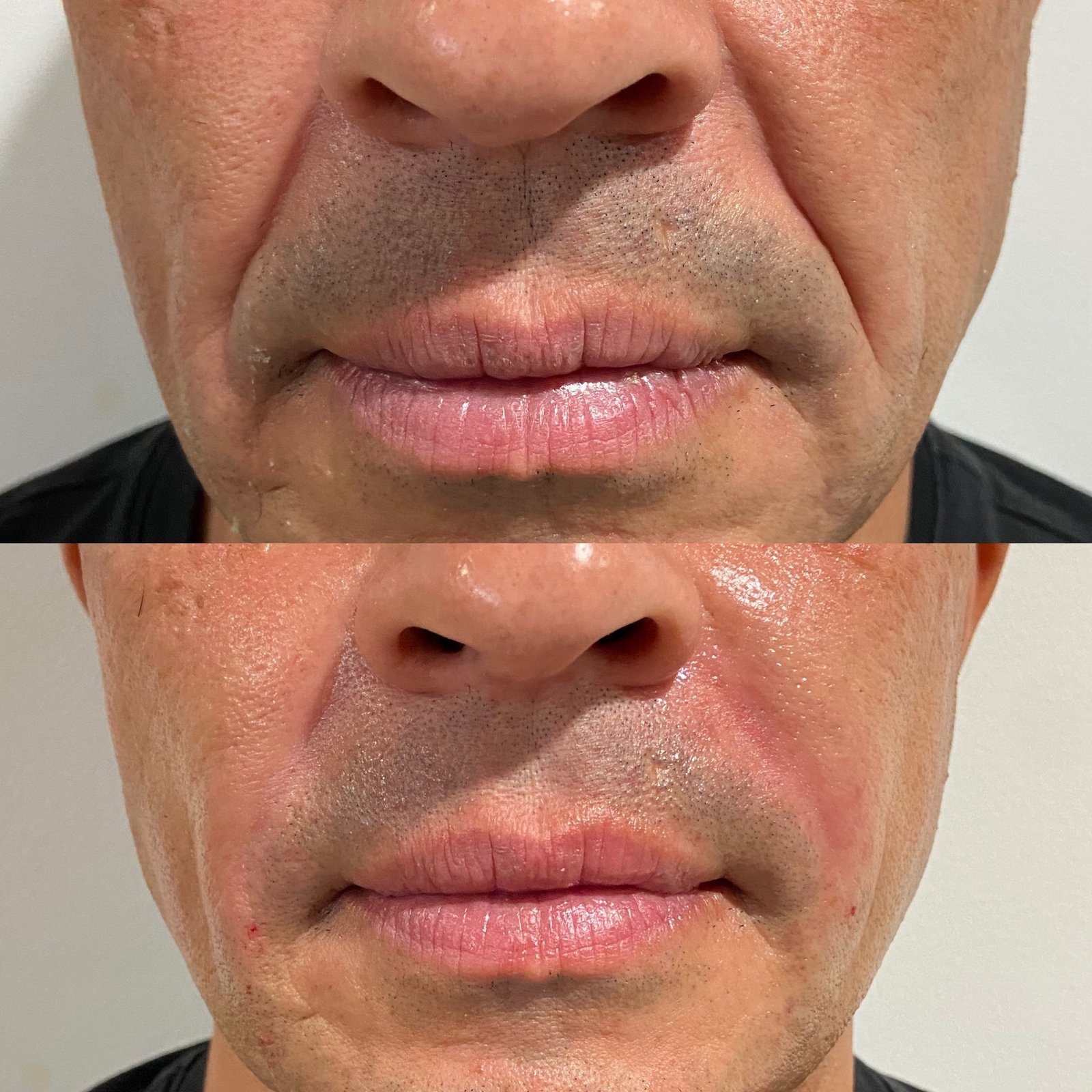 The Hair Mission Clinic