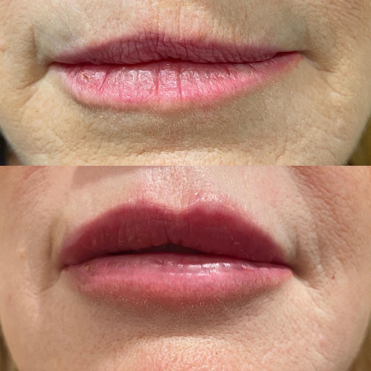 The Hair Mission Clinic