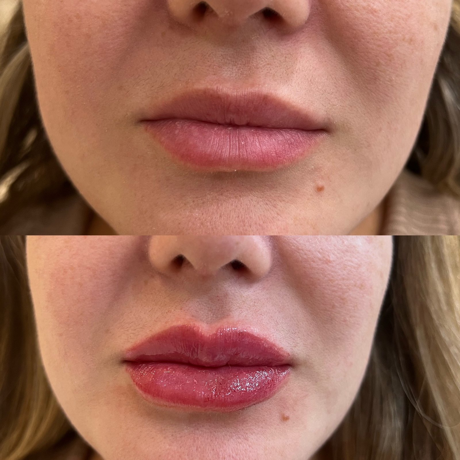 The Hair Mission Clinic