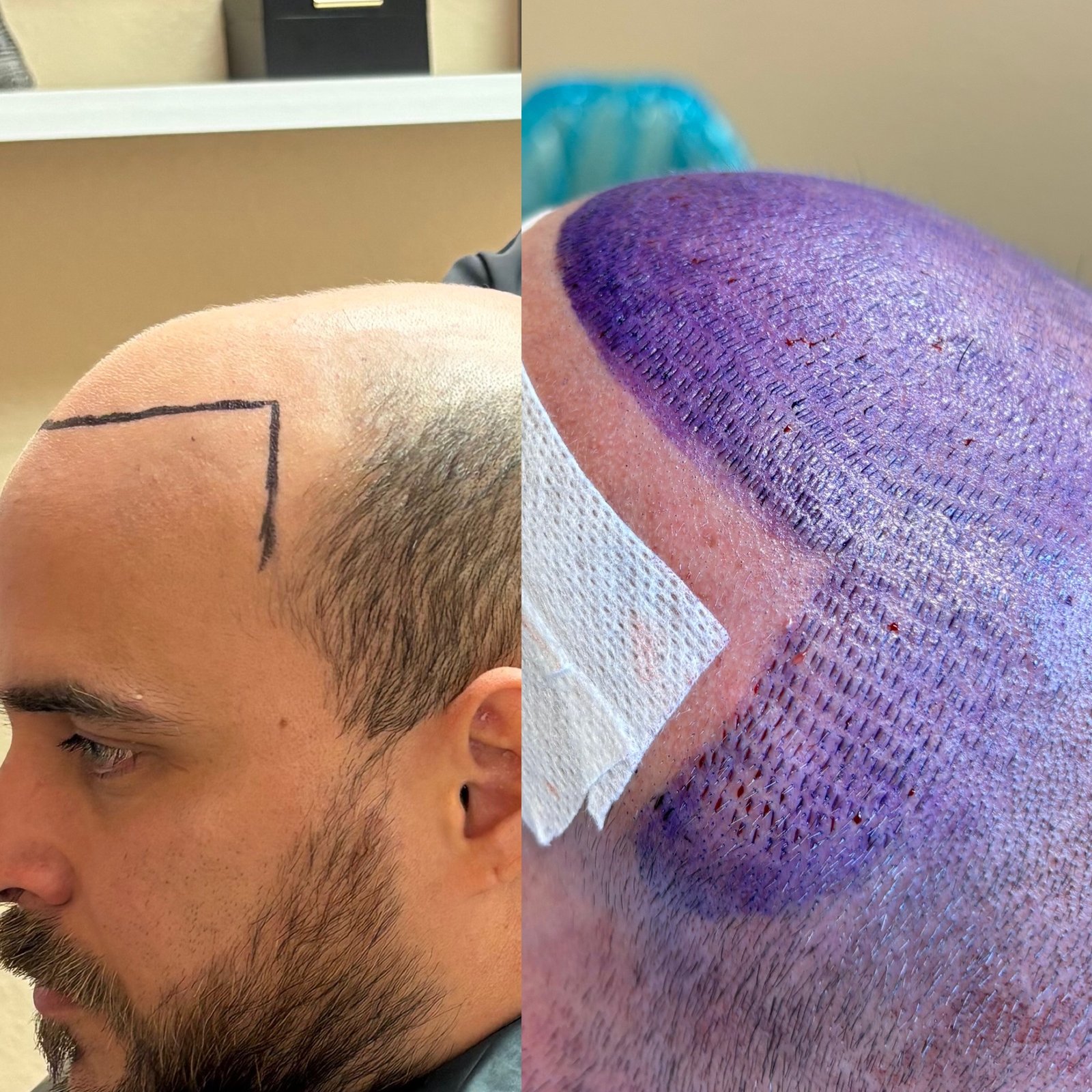 The Hair Mission Clinic